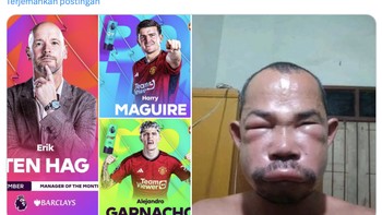 Penghargaan yang diraih MU seakan langsung sirna. Foto: X