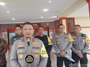 Kapolda Sumut Pastikan 5 Mayat di Unpri Cadaver