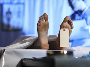 Kata Ahli Anatomi soal Kadaver, Jenazah yang Jadi Bahan Praktikum di Kedokteran