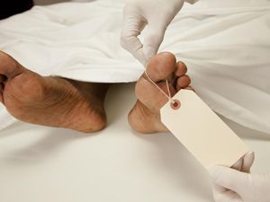 Kata Dokter Anatomi soal Etika Perlakukan Jenazah Cadaver
