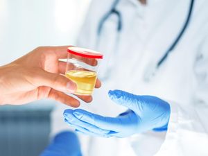 Peneliti Pecahkan Misteri 150 Tahun Penyebab Urine Berwarna Kuning