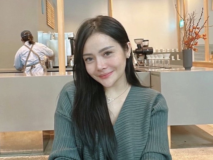Selain Operasi Hidung, Mawar AFI Juga Cafe Hopping Saat di Korea