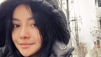 Begini penampilan terbaru Mawar AFI usai mengoperasi hidungnya di Korea Selatan. Ia mengatakan alasan operasi hidung adalah untuk kepentingan medis dimana ada penyempitan rongga hidung di sebelah kiri. Foto: Instagram mysamawar