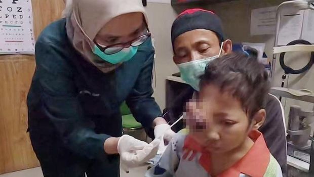 Berawal dari gatal di area mata, Assyfa didiagnosa menderita Massa Cavum Nasi Dextra atau tumor rongga hidung