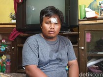 Cerita Satpam di Medan Dianiaya Gerombolan Pria Cepak, Perut Ditusuk Sangkur