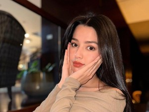 Cerita Susan Sameh Dibully Saat Kecil Karena Alergi Panas