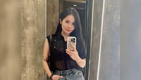 Mawar AFI belum lama ini melakukan operasi hidung. (Foto: dok Instagram)