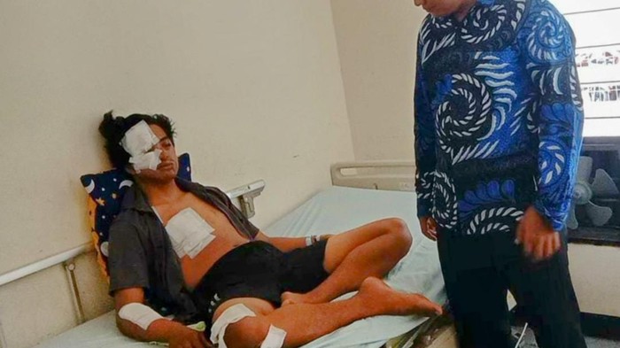 Seorang pemuda diduga dianiaya oknum polisi di Situbondo. Kapolres Situbondo AKBP Dwi Sumrahadi.