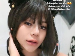 7 Foto Terbaru Cimoy Montok Setelah Oplas Hidung, Wajahnya Kini Manglingi