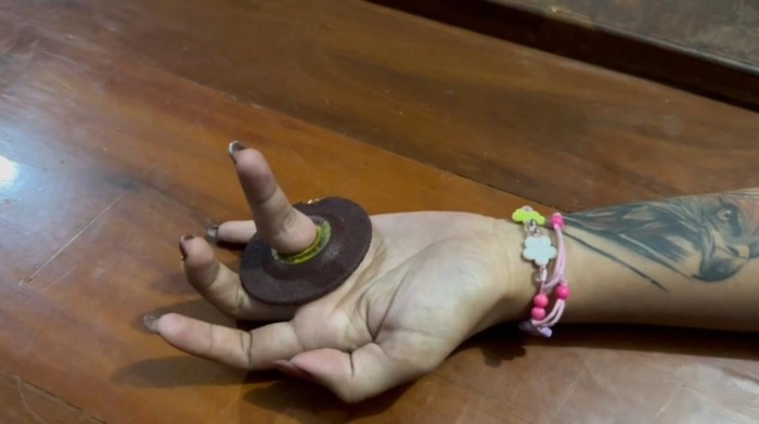 Penampakan jari perempuan di Trenggalek nyangkut di gerinda