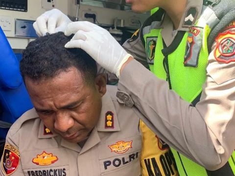Kapolres Jayapura AKBP Fredrickus WA Maclarimboen saat dirawat usai terkena lemparan batu saat  kericuhan pengantaran jenazah mantan Gubernur Papua Lukas Enembe. Dokumen Istimewa