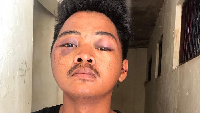Wawan (22), jukir di Makassar diamuk warga kepergok curi motor.