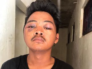 Jukir di Makassar Babak Belur Diamuk Warga Usai Kepergok Curi Motor Ojol