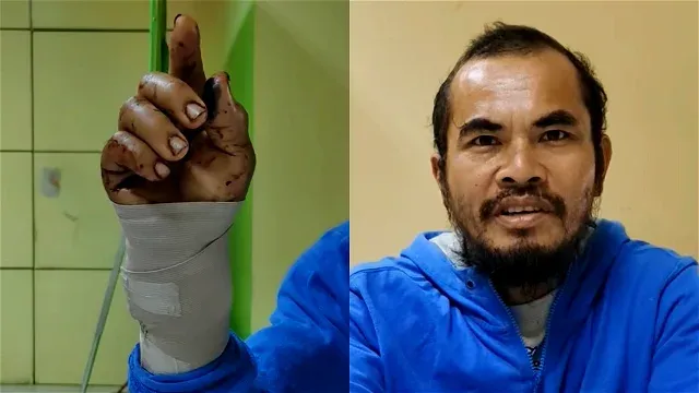 Bojulio Aleria Mengigit ular piton