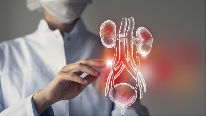 Mengenal ECIRS, Tatalaksana bagi Kasus Batu Saluran Kemih Kompleks