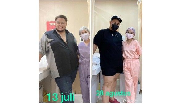 Selain Kahiyang Ayu, 5 Selebriti Ini Juga Berhasil Turunkan Berat Badan Puluhan Kg!