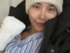Kisah Tragis Model yang Tangannya Diamputasi karena Alasan Mistrerius