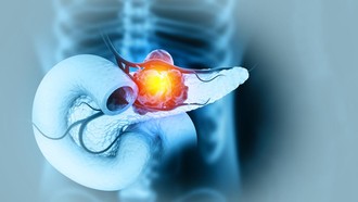 Dikira Sakit Punggung Biasa, Pria Ini Ternyata Idap Kanker Pankreas