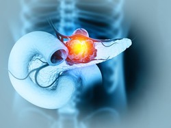 Sering Dikonsumsi buat Diet, Ternyata Tanaman Ini Bisa Lawan Kanker