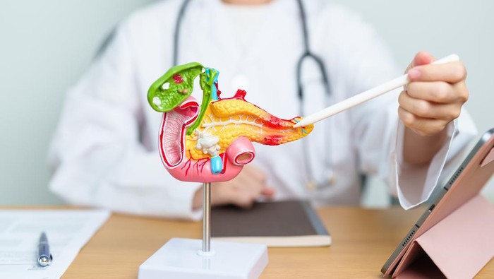 Ilustrasi pankreas Doctor with human Pancreatitis anatomy model with Pancreas, Gallbladder, Bile Duct, Duodenum, Small intestine and tablet. Pancreatic cancer, acute pancreatitis and Digestive system