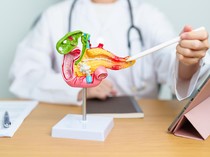 Cek Tanda Kanker Pankreas dari Feses, Ini Ciri-cirinya