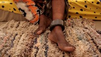 Senegal tahun lalu mengatakan pihaknya menjadi negara pertama di Afrika Barat yang menempatkan tahanan tertentu di bawah pengawasan elektronik, sebagai bagian dari upaya mengurangi kepadatan penjara, yang merupakan masalah yang tersebar luas di benua itu. Menurut database World Prison Brief (WPB), populasi narapidana melebihi kapasitas penjara di 42 dari 47 negara dan wilayah Afrika. Data terbaru untuk Senegal menunjukkan tingkat okupansi sekitar 130% lebih tinggi dari kapasitas resmi pada bulan Maret 2018.