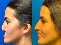 Viral Influencer Kehilangan Bibir usai Diserang Anjing, Biaya Oplasnya Miliaran