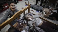 Kantor Media Pemerintah Gaza menyebut tak ada bahan bakar yang tersisa untuk mengaktifkan generator di Al-Aqsa Martyr Hospital. Pasien yang dirawat di ICU dihadapkan dengan risiko kematian. (AP Photo/Mohammed Dahman)  