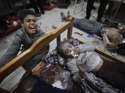 Kisah Pilu Dokter Rawat Anak-anak yang Matanya Hancur Imbas Ledakan di Gaza