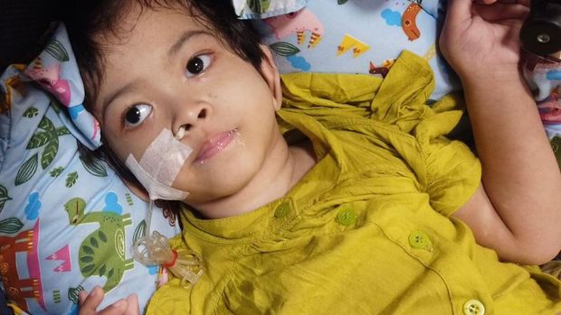 Ariqah, anak penderita cerebral palsy (Foto: berbuatbaik.id)