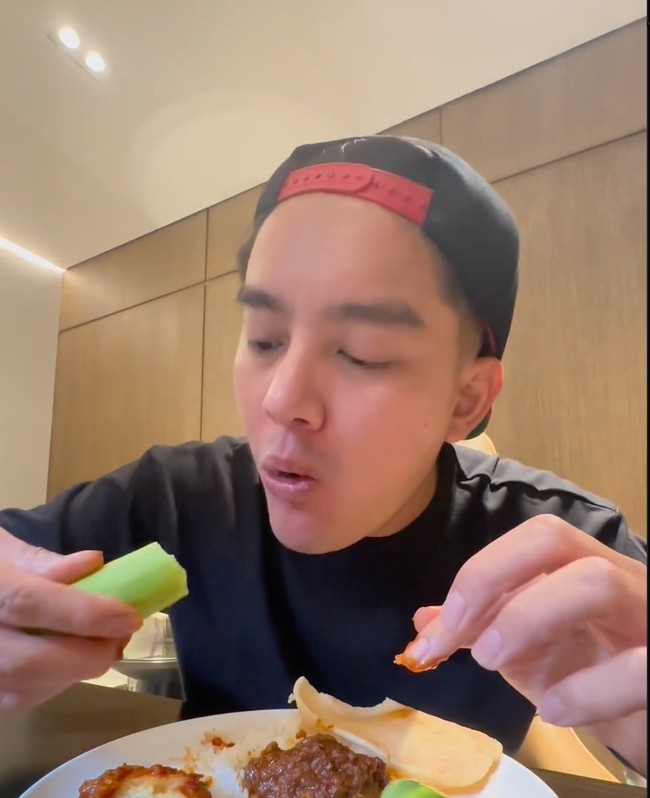 Boy William mengaku bahwa operasi tersebut hanya meluruskan tulang hidungnya. Dan agar terlihat lebih indah, bagian tengah diantara kedua cuping hidungnya itu juga ditarik sedikit ke bawah. “Rekomendasi dari dokter, selain kita ngebenerin batangnya doang secara medis, estetikanya aja sekalian mumpung lagi tidur juga,” terang Boy. Foto: Instagram/@boywilliam17