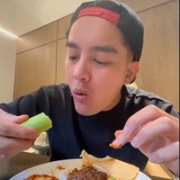 Boy William mengaku bahwa operasi tersebut hanya meluruskan tulang hidungnya. Dan agar terlihat lebih indah, bagian tengah diantara kedua cuping hidungnya itu juga ditarik sedikit ke bawah. “Rekomendasi dari dokter, selain kita ngebenerin batangnya doang secara medis, estetikanya aja sekalian mumpung lagi tidur juga,” terang Boy. Foto: Instagram/@boywilliam17