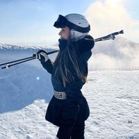 “Itu sudah terjadi. Kamu pasti menemukan cara untuk berdamping dengn hal-hal yang tidak bisa diubah. Tapi kekuatan dan kemampuan beradaptasi manusia sangat kuat. Pada hari kelima operasi, aku sudah menerimanya dan menanti dunia baru setelah membaca soal teknologi bionik,” kata Jessica. Foto: Instagram Jessica Du