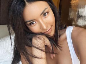 Potret Model yang Kisahnya Tragis, Tangan Diamputasi karena Alasan Misterius