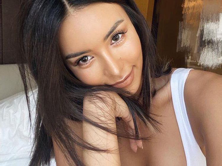 Potret Model yang Kisahnya Tragis, Tangan Diamputasi karena Alasan Misterius