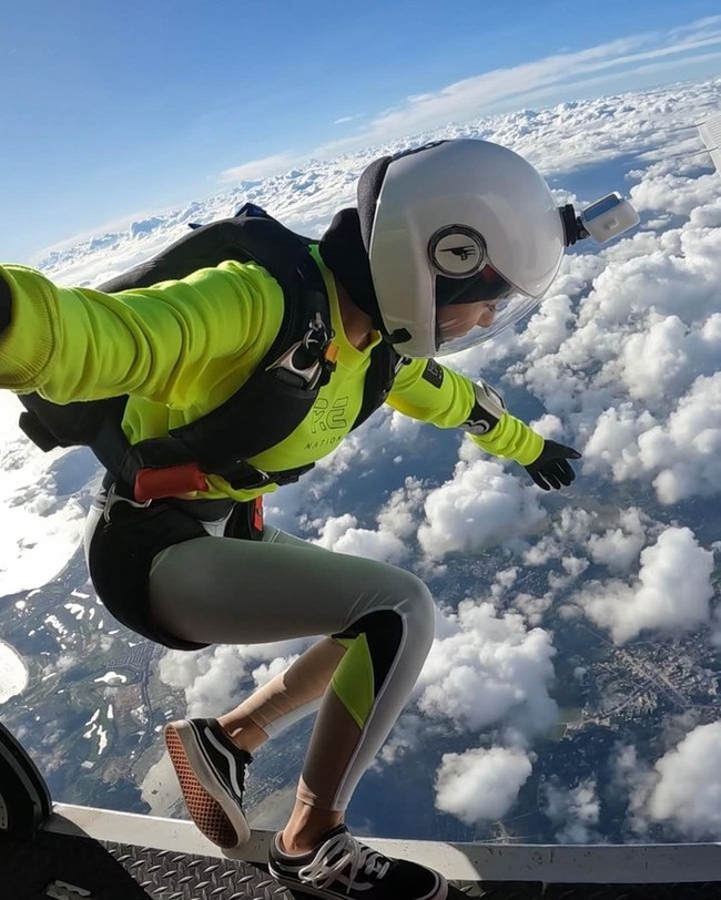 Jessica sendiri tidak mengungkap alasan atau detail dari kecelakaan yang dialaminya. Tapi wanita tersebut sebelumnya sering menampilkan gayanya bermain sky diving dan ski. Dikatakan jika ia akan menceritaknnya lebih lanjut setelah operasi ketiga. Foto: Instagram Jessica Du