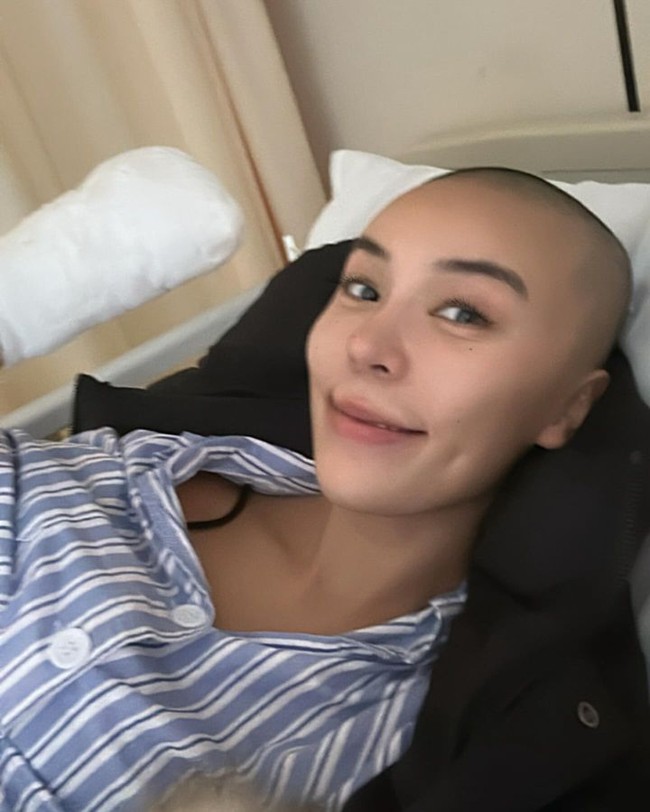 Jessica tentu mengejutkan publik dengan kabar terbarunya itu. Dalam postingan di Instagram, ia tampak berbaring di tempat tidur rumah sakit. Masih menampilkan wajah tersenyum, ternyata ia mengalami kondisi yang serius. Jessica bahkan harus kehilangan tangan kanannya yang diamputasi. Foto: Instagram Jessica Du