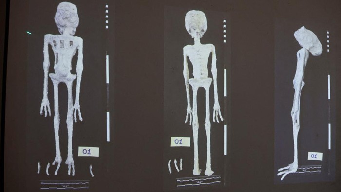Foto-foto penelitian yang dilakukan Institute of Legal Medicine of Peru terhadap mumi alien yang membuktikan bahwa itu adalah boneka yang terbuat dari tulang binatang, kertas dan metal.
