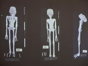 Misteri Mumi Alien Lagi-lagi Bikin Heboh usai Ditemukan Dua Jasad Baru di Peru