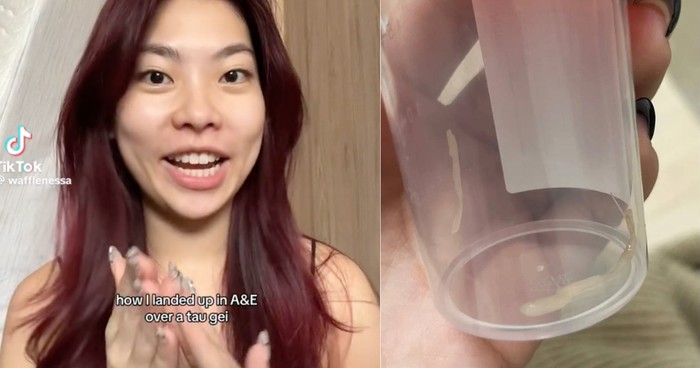 Ada Tauge Nyangkut di Tenggorokannya, Wanita Ini Habiskan 9 Jam di Rumah Sakit