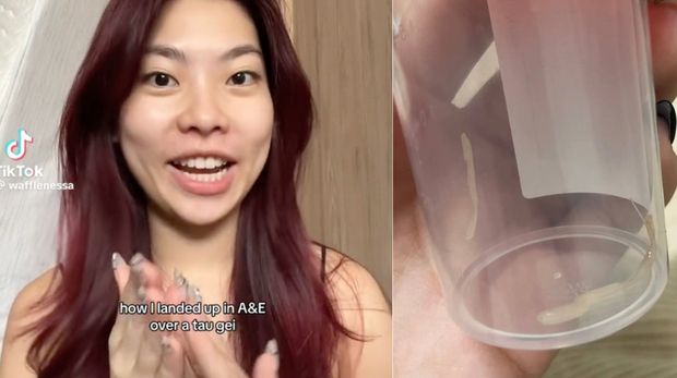 Ada Tauge Nyangkut di Tenggorokannya, Wanita Ini Habiskan 9 Jam di Rumah Sakit