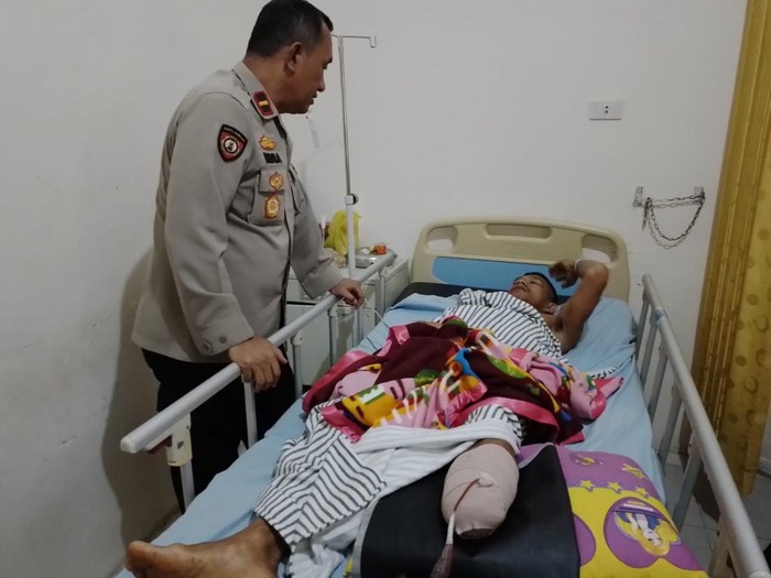 Joni, petani yang kakinya putus usai diserang beruang di Ogan Komering Ulu.