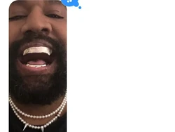 Kanye West Tampil dengan Gigi Titanium ala Musuh James Bond, Rogoh Rp 13 M