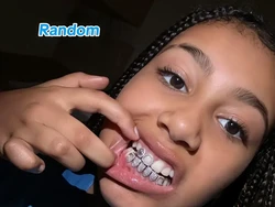 North West Pamer Gigi Lapis Berlian, Sebut Dirinya Random