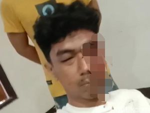 Saddan Babak Belur Dianiaya 3 Anggota Brimob
