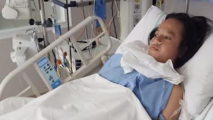 Devi, wanita yang tertabrak truk tronton