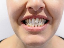 Dokter Ungkap Kebiasaan Masa Kecil yang Bikin Gigi Berantakan saat Dewasa