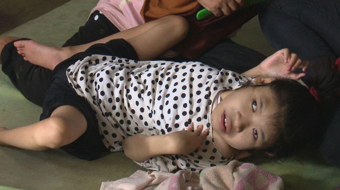 Intan, anak berkebutuhan khusus di Sukabumi