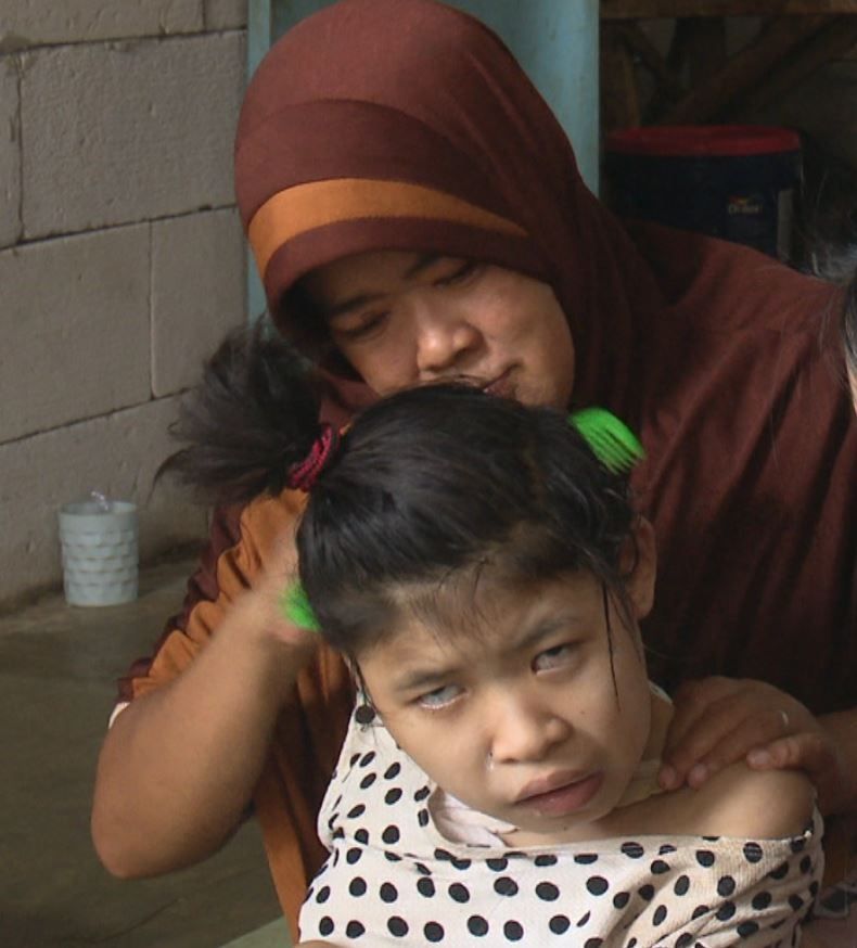 Intan, anak berkebutuhan khusus di Sukabumi