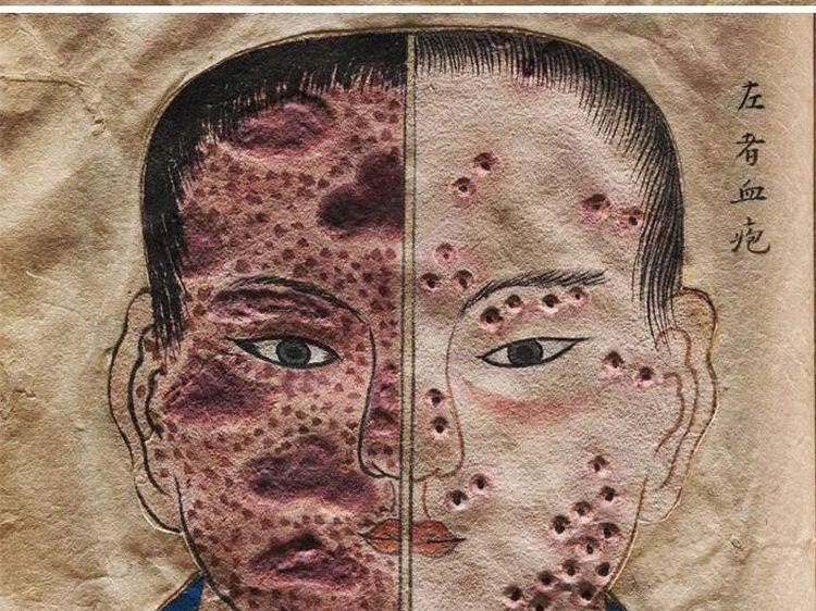Benda Langka Koleksi Museum, Ada yang Menyeramkan